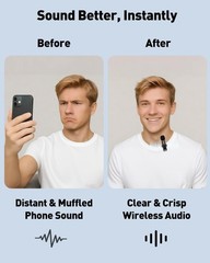 Ultimate USB-C Wireless Microphone Kit with Windscreen & Rechargeable Design