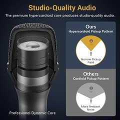 High-Sensitivity Karaoke Microphone with 450cm XLR Cable – Perfect for Singers